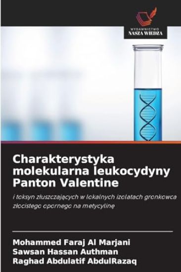 Charakterystyka molekularna leukocydyny Panton Valentine