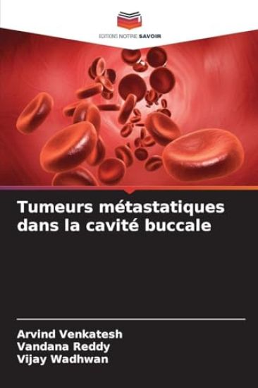 Tumeurs métastatiques dans la cavité buccale