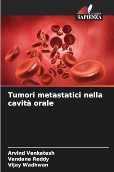 Tumori metastatici nella cavità orale