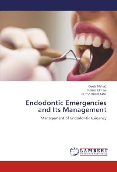 Endodontic Emergencies and Its Management
