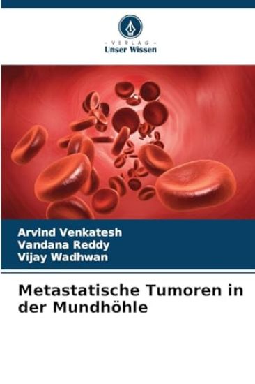 Metastatische Tumoren in der Mundhöhle