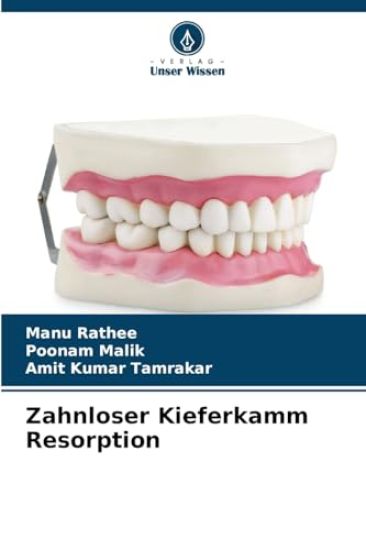 Zahnloser Kieferkamm Resorption