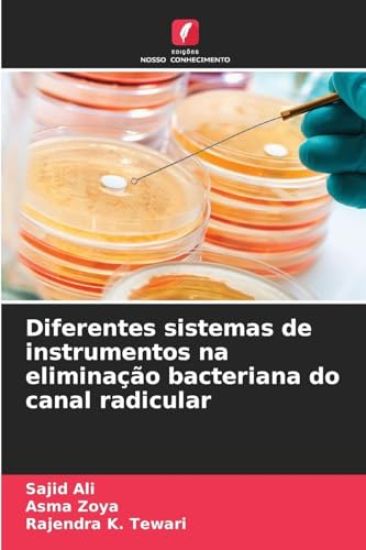 Diferentes sistemas de instrumentos na eliminação bacteriana do canal radicular