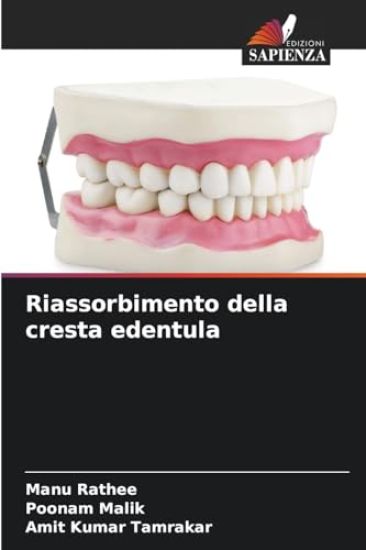 Riassorbimento della cresta edentula