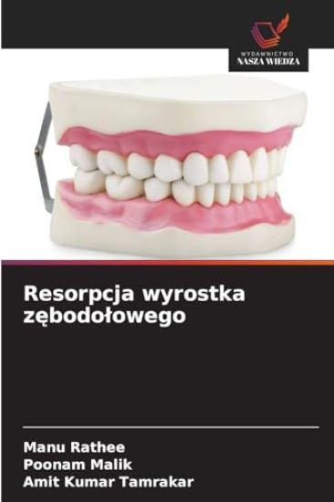 Resorpcja wyrostka zebodolowego