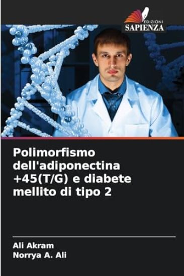 Polimorfismo dell'adiponectina +45(T/G) e diabete mellito di tipo 2