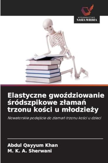 Elastyczne gwozdziowanie sródszpikowe zlaman trzonu kosci u mlodziezy