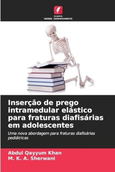 Inserção de prego intramedular elástico para fraturas diafisárias em adolescentes