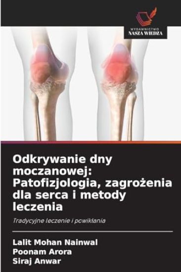 Odkrywanie dny moczanowej