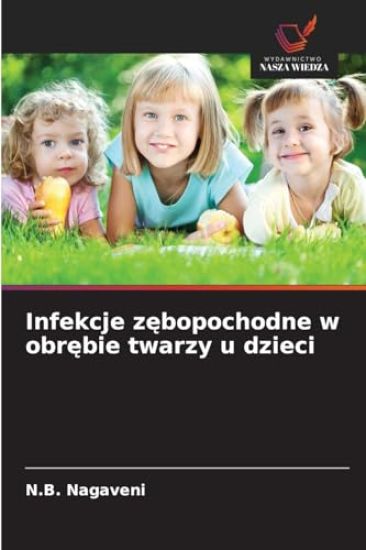 Infekcje zebopochodne w obrebie twarzy u dzieci