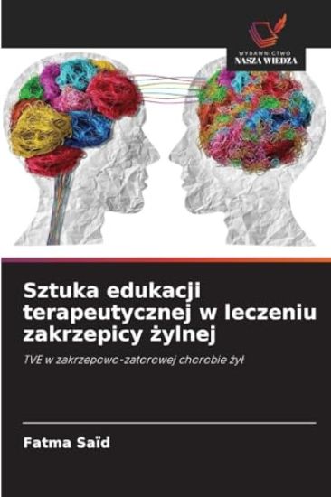 Sztuka edukacji terapeutycznej w leczeniu zakrzepicy zylnej