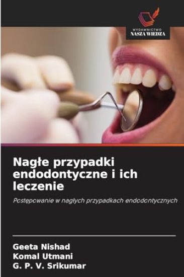 Nagle przypadki endodontyczne i ich leczenie