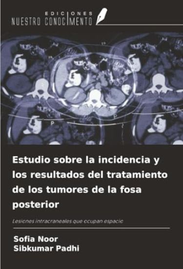 Estudio sobre la incidencia y los resultados del tratamiento de los tumores de la fosa posterior