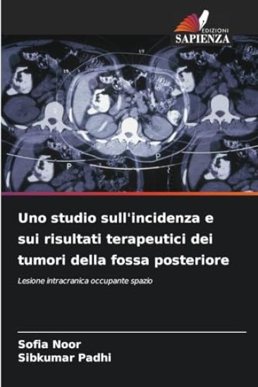 Uno studio sull'incidenza e sui risultati terapeutici dei tumori della fossa posteriore