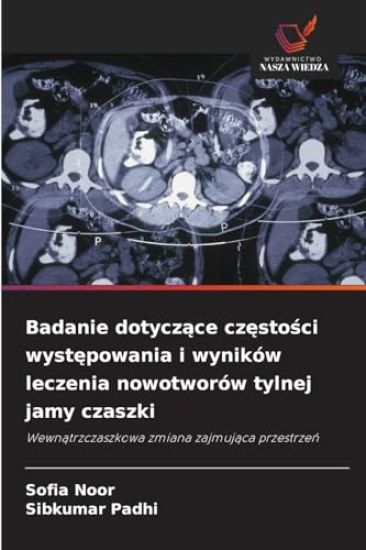 Badanie dotyczące częstości występowania i wyników leczenia nowotworów tylnej jamy czaszki