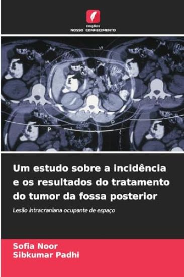 Um estudo sobre a incidência e os resultados do tratamento do tumor da fossa posterior