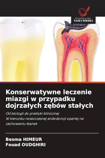 Konserwatywne leczenie miazgi w przypadku dojrzalych zebów stalych