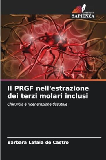 Il PRGF nell'estrazione dei terzi molari inclusi