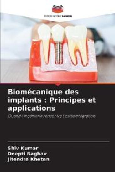 Biomécanique des implants
