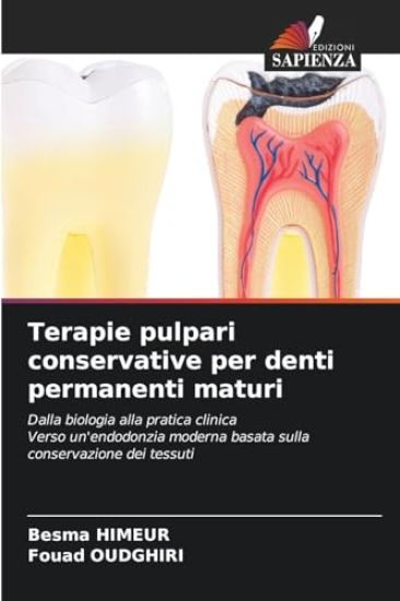 Terapie pulpari conservative per denti permanenti maturi