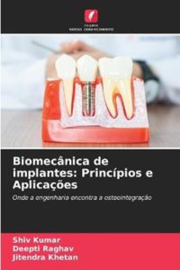 Biomecânica de implantes