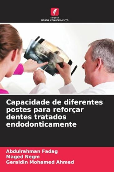 Capacidade de diferentes postes para reforçar dentes tratados endodonticamente