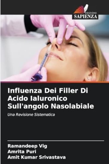 Influenza Dei Filler Di Acido Ialuronico Sull'angolo Nasolabiale