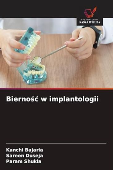 Biernośc w implantologii