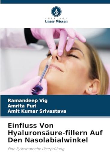 Einfluss Von Hyaluronsäure-fillern Auf Den Nasolabialwinkel