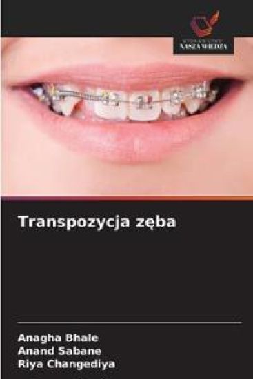 Transpozycja zeba