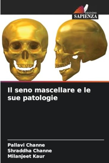 Il seno mascellare e le sue patologie