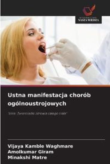 Ustna manifestacja chorób ogólnoustrojowych