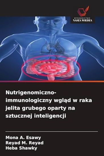 Nutrigenomiczno-immunologiczny wgl¿d w raka jelita grubego oparty na sztucznej inteligencji