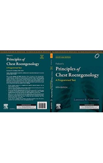 Felson's Principles of Chest Roentgenology, A Programmed Text, 5 Edition: South Asia Edition