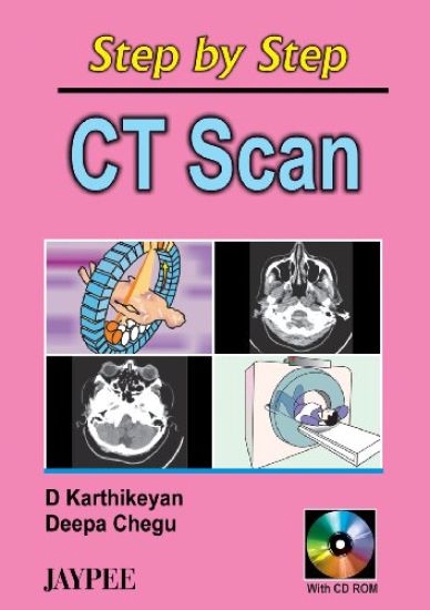Step by Step CT Scan