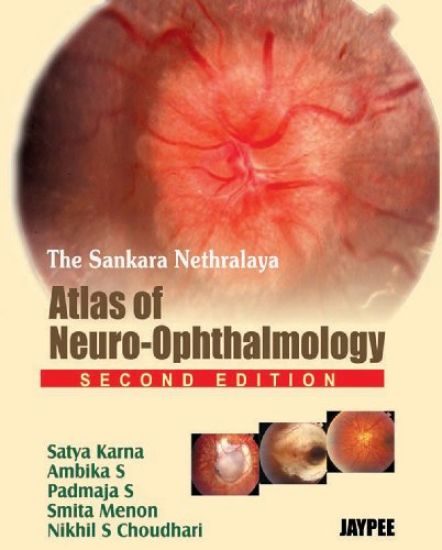 The Sankara Nethralaya's: Atlas of Neuro-Ophthalmology