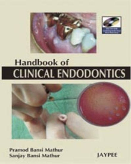 A Hand Book of Clinical Endodontics