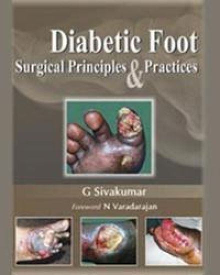 Diabetic Foot