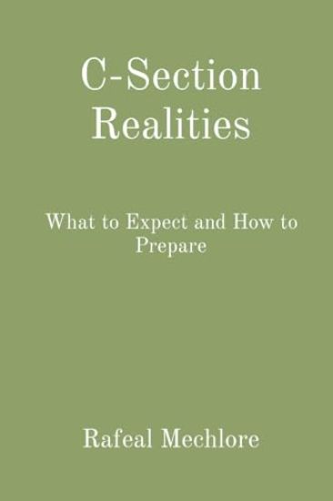 C-Section Realities