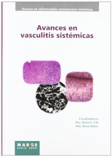 Avances en vasculitis sistémicas