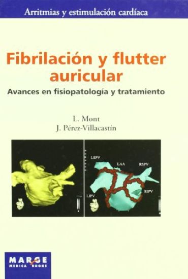 Fibrilaci?n y flutter auricular