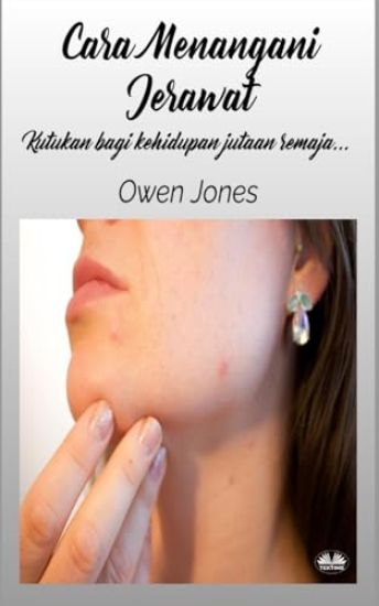 Cara Menangani Jerawat