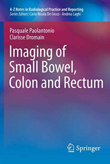 Imaging of Small Bowel, Colon and Rectum