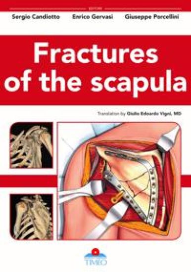 Fractures of the Scapula