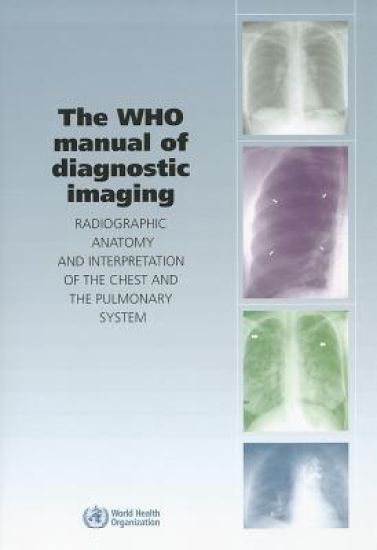 The WHO Manual of Diagnostic Imaging