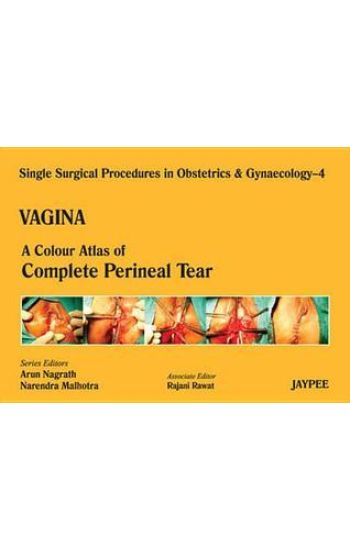 Single Surgical Procedures in Obstetrics and Gynaecology - Volume 4 - VAGINA