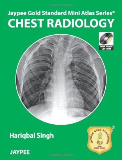 Jaypee Gold Standard Mini Atlas Series: Chest Radiology
