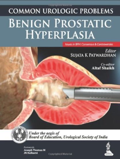 Common Urologic Problems: Benign Prostatic Hyperplasia