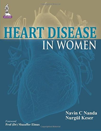 Heart Disease in Women