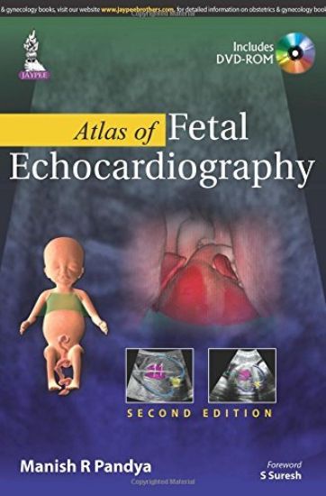 Atlas of Fetal Echocardiography